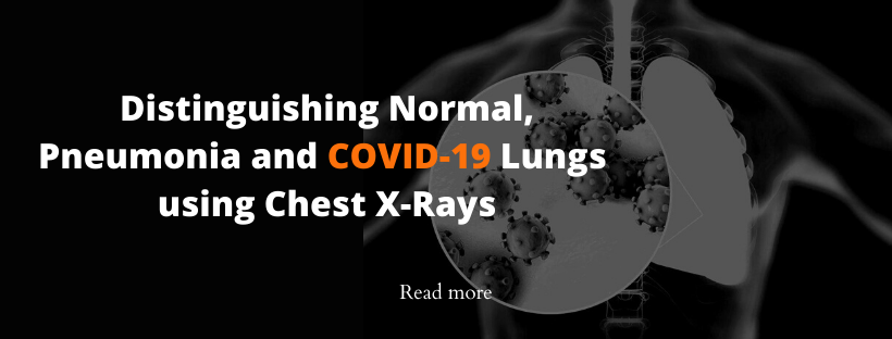 Distinguishing-Normal-Pneumonia-and-COVID-19-Chest-X-Ray-images
