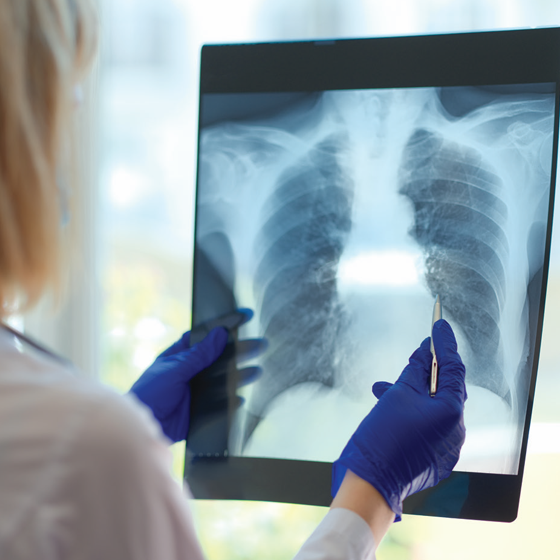 Understanding-Disease-COVID-Progression-using-Chest-X-Rays